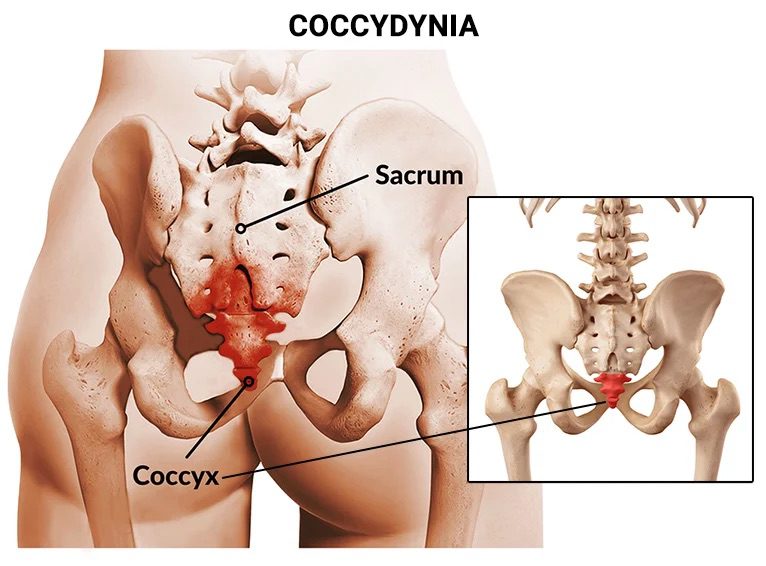 Coccyx